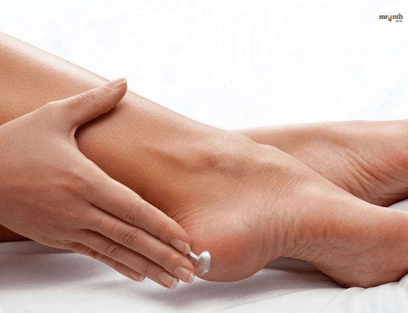 Thoa kem dưỡng ẩm lên gót giày qua đêm giúp da giày mềm, giảm ma sát và chữa đau gót chân khi đi giày