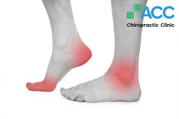 Đi Giày Cao Gót Bị Đau Ngón Chân: Giải Pháp Khắc Phục Hiệu Quả