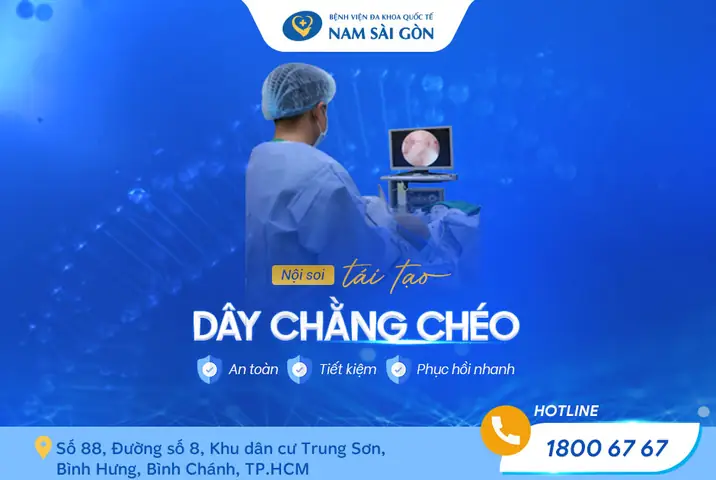 Sau Tái Tạo Dây Chằng Có Thể Mang Giày: Khi Nào Và Loại Nào Phù Hợp?