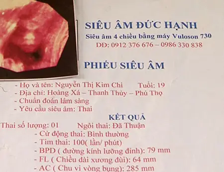 Vụ việc bắt đối tượng vận chuyển 11000 đôi giày: Chi tiết và hậu quả