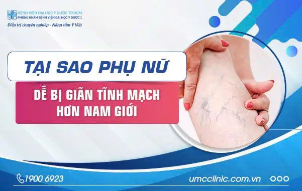 Bị Giãn Tĩnh Mạch Chân Có Nên Mang Giày Và Lựa Chọn Thế Nào?