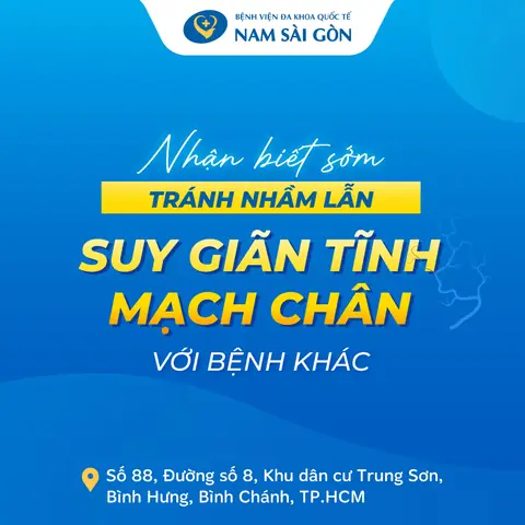 NHẬN BIẾT SỚM TRÁNH NHẦM LẪN SUY GIÃN TĨNH MẠCH CHÂN VỚI BỆNH KHÁC