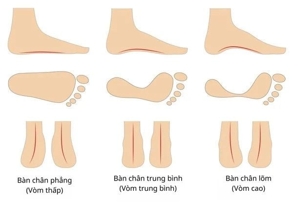 Hình ảnh minh họa các kiểu vòm bàn chân khác nhau và cách chúng ảnh hưởng đến việc chọn giày