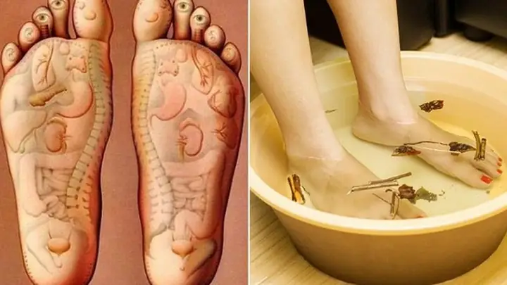 2cách Trị Dứt Điểm Hôi Chân Bằng Những Nguyên Liệu Có Sẵn