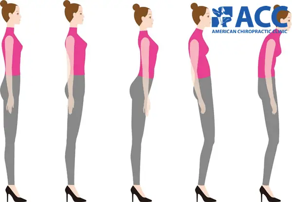 1.1. Tư Thế Và Dáng Đi Bất Thường 1.1. Tư Thế Và Dáng Đi Bất Thường